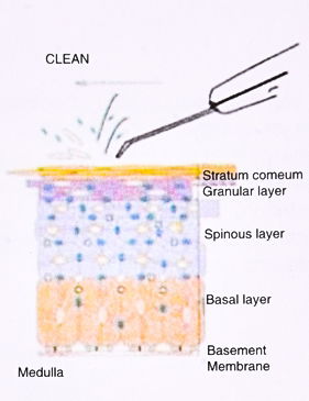 How to use - Deep Cleanse Treatment