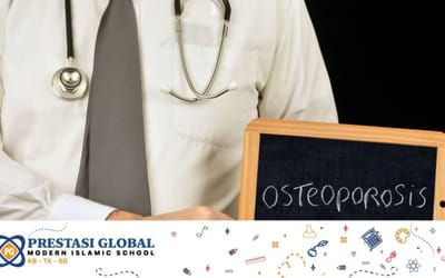Awas! Osteoporosis Dapat Terjadi Pada Anak dan Bisa Mengganggu Tumbuh Kembangnya