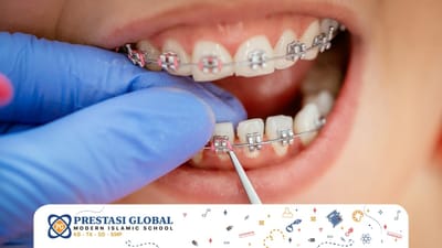 Anak Memiliki Gigi yang Kurang Rapih? Kapan Anak Boleh Memakai Kawat Gigi?