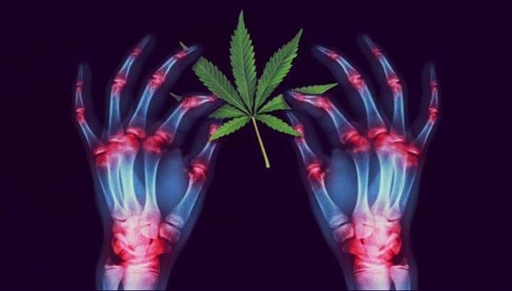 ¿Que es el sistema endocannabinoiede?