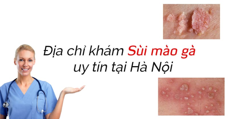 Kham chua va xet nghiem sui mao ga o dau uy tin tai Ha Noi