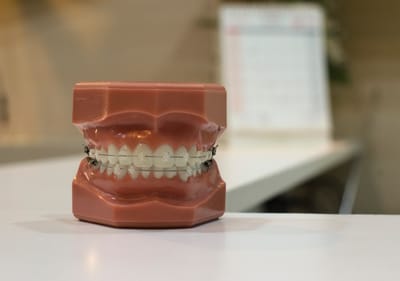 Dental aesthetics 4 image