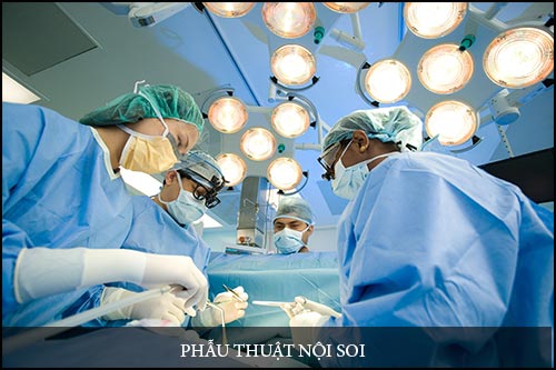 Chia sẻ các ưu điểm phương pháp phẫu thuật nội soi