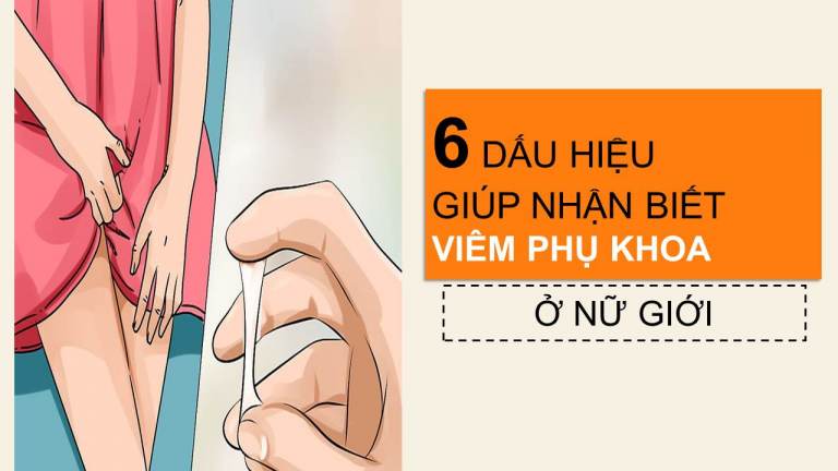 Phương pháp chữa viêm phụ khoa nào tốt nhất