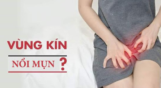 Vung kin bi ngua va noi mun phai lam sao
