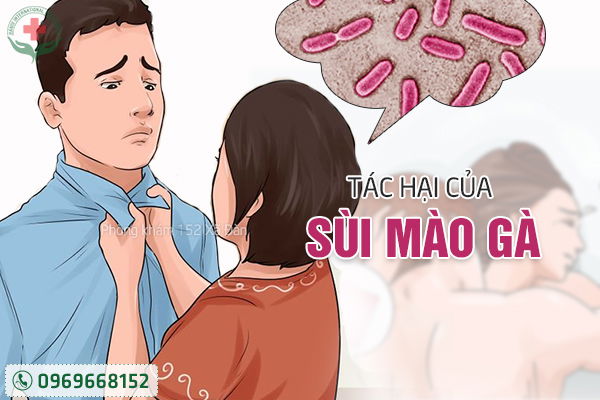 Đốt sùi mào gà và điều cần biết