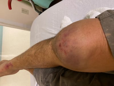 trauma treated without surgeries