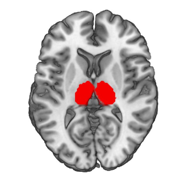 Structural MR