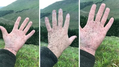 Why Scotland Have So Many Midges?
