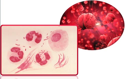 Chua benh lau bao nhieu tien