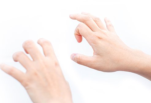 Trigger Finger Pain Management – Reliving Your Pain