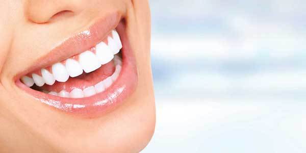 An Overview of Teeth Whitening Treatment