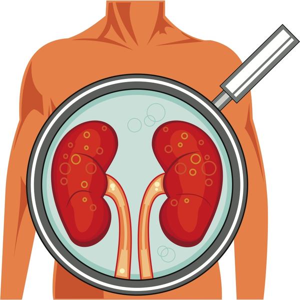 How to lower high creatinine level without dialysis
