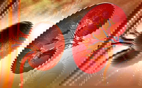 High creatinine 5.6 in Diabetic Kidney Disease