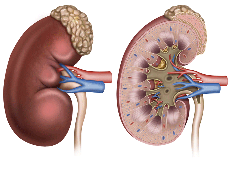 What is treatment for high creatinine 5