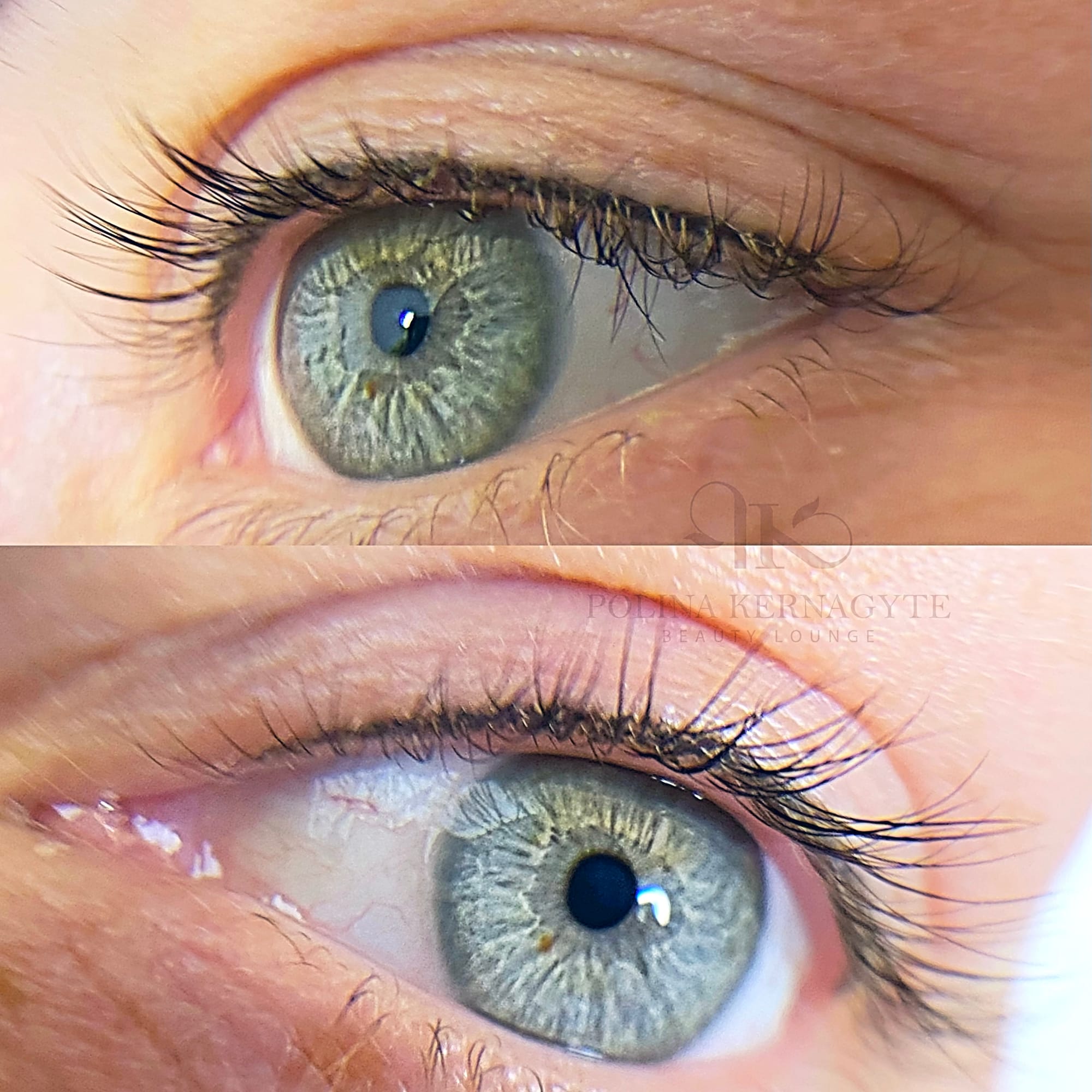 Lash enhancement