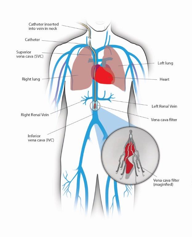 Arteries