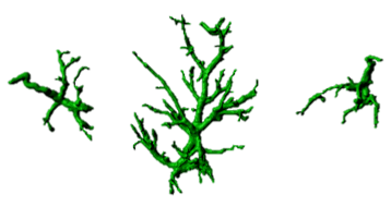 Reactive astrocytes in brain disorders