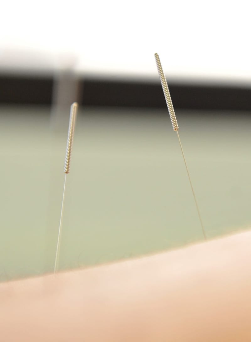 Neurobiological Mechanism of Acupuncture