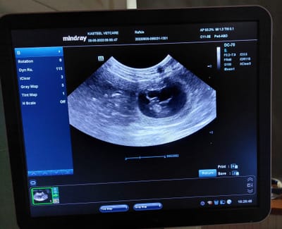 Thinley, Rafale et l’évolution des minis embryons