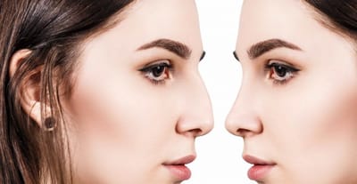 Importance And Benefits Of choosing A Rhinoplasty Surgeon For Reshaping Your Nose