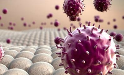Disease 1: Type 1 Diabetes image