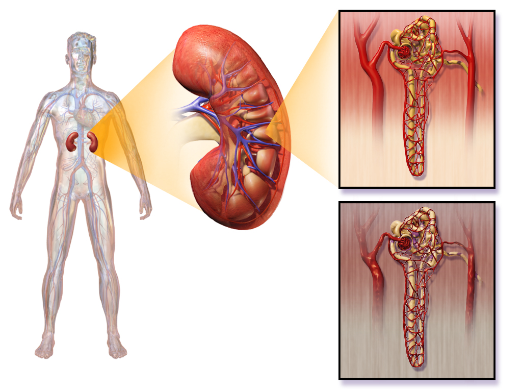 كيفية استخدام الطب الصيني علاج يوريمية