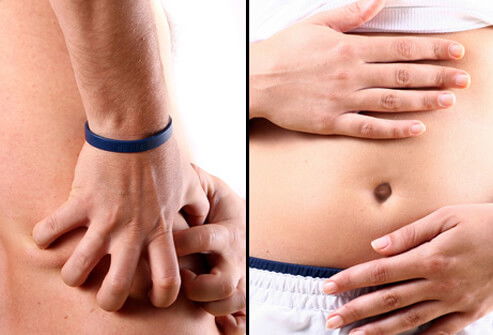 الطب الجزئي الصيني أوزموثيرابي هو في الوقت الحاضر التكنولوجيا المتقدمة لعلاج الفشل الكلوي