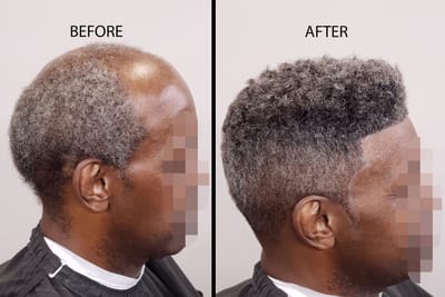 Hair Unit Services image