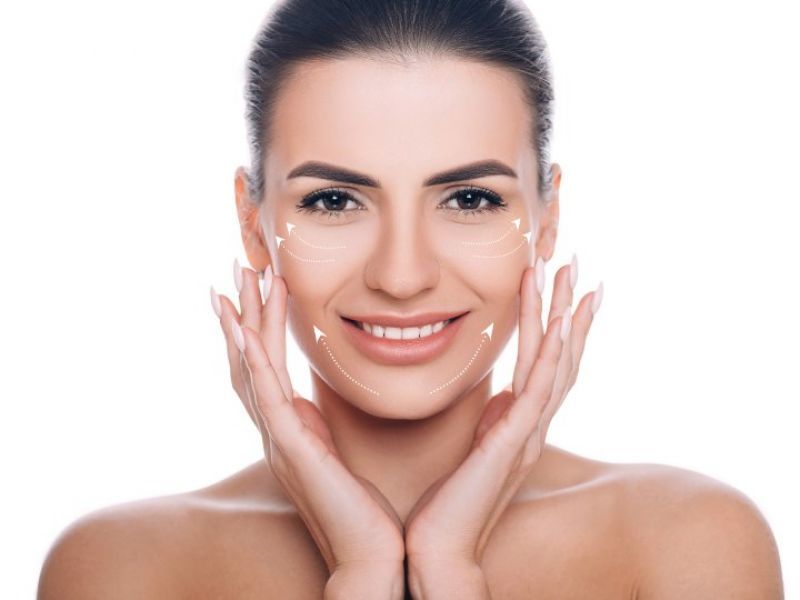 Lifting facial (rejuvenecimiento facial)