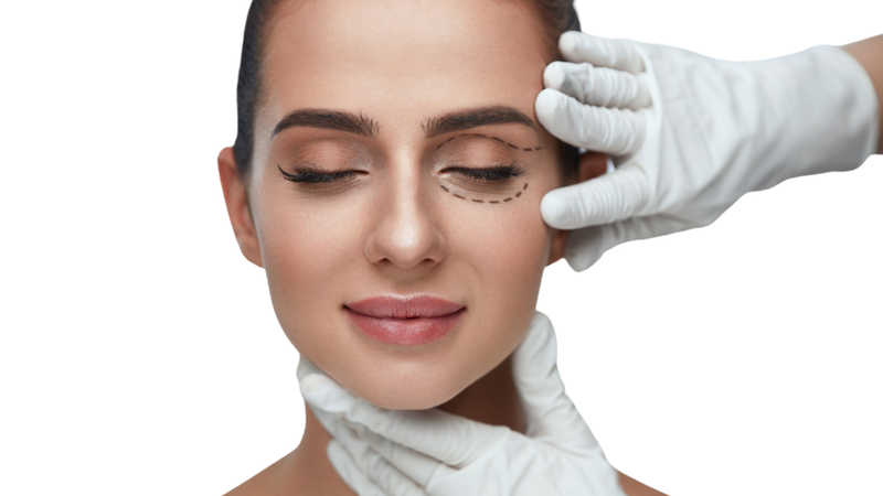 BLEFAROPLASTIA (CIRUGÍA DE PÁRPADOS)