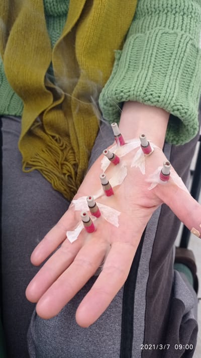 הורדת סטרס העלאת חיוניות