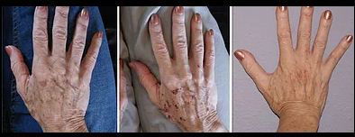 How To Choose A Good Laser Clinic In Toronto?