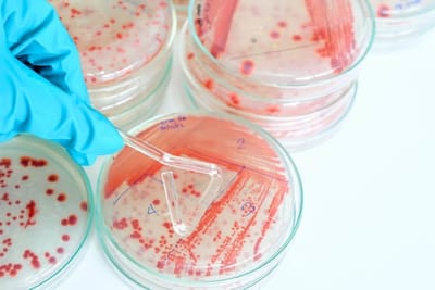 Cultivo bacteriano.