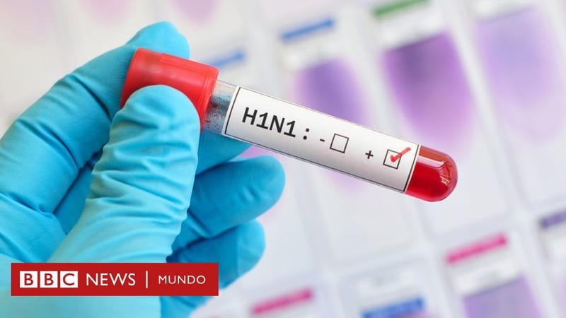 Pandemia gripe A (H1N1).