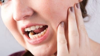 Composite Front Tooth Filling And Bonding - Should You Have It Replaced?