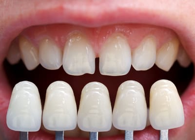 Dentist open today? You've come to the right place