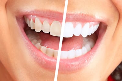 Are you looking for the best dentist office near me?