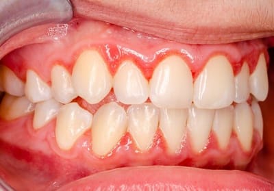 How to Find the Best Dental Clinic Near Me