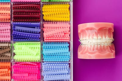 How to Choose Cute Colors for Braces