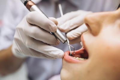 Dentist Open on Saturday Near Me