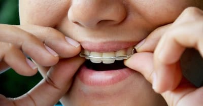 Which dental insurance plan is best for you