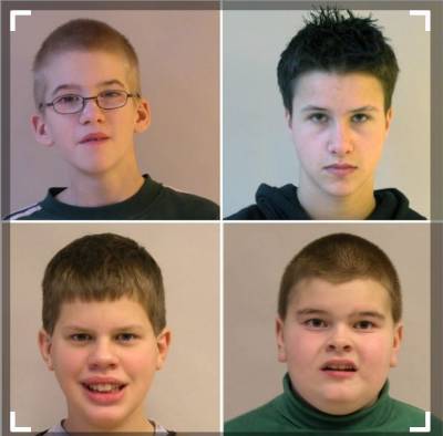 SINDROME DE KLINEFELTER
