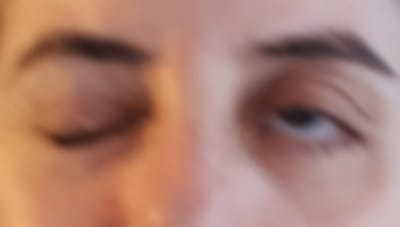 פציאליס image