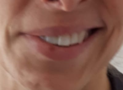 פציאליס image