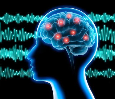 Convulsiones/ Epilepsia