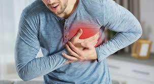 Infarto al corazón