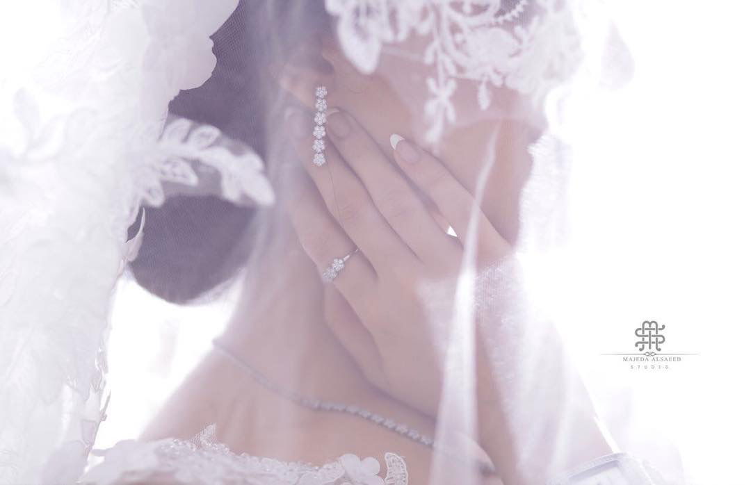 تصويرالآعراس