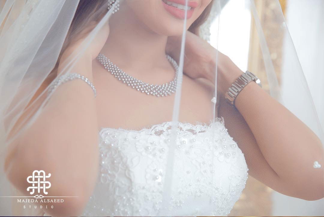 تصويرالآعراس