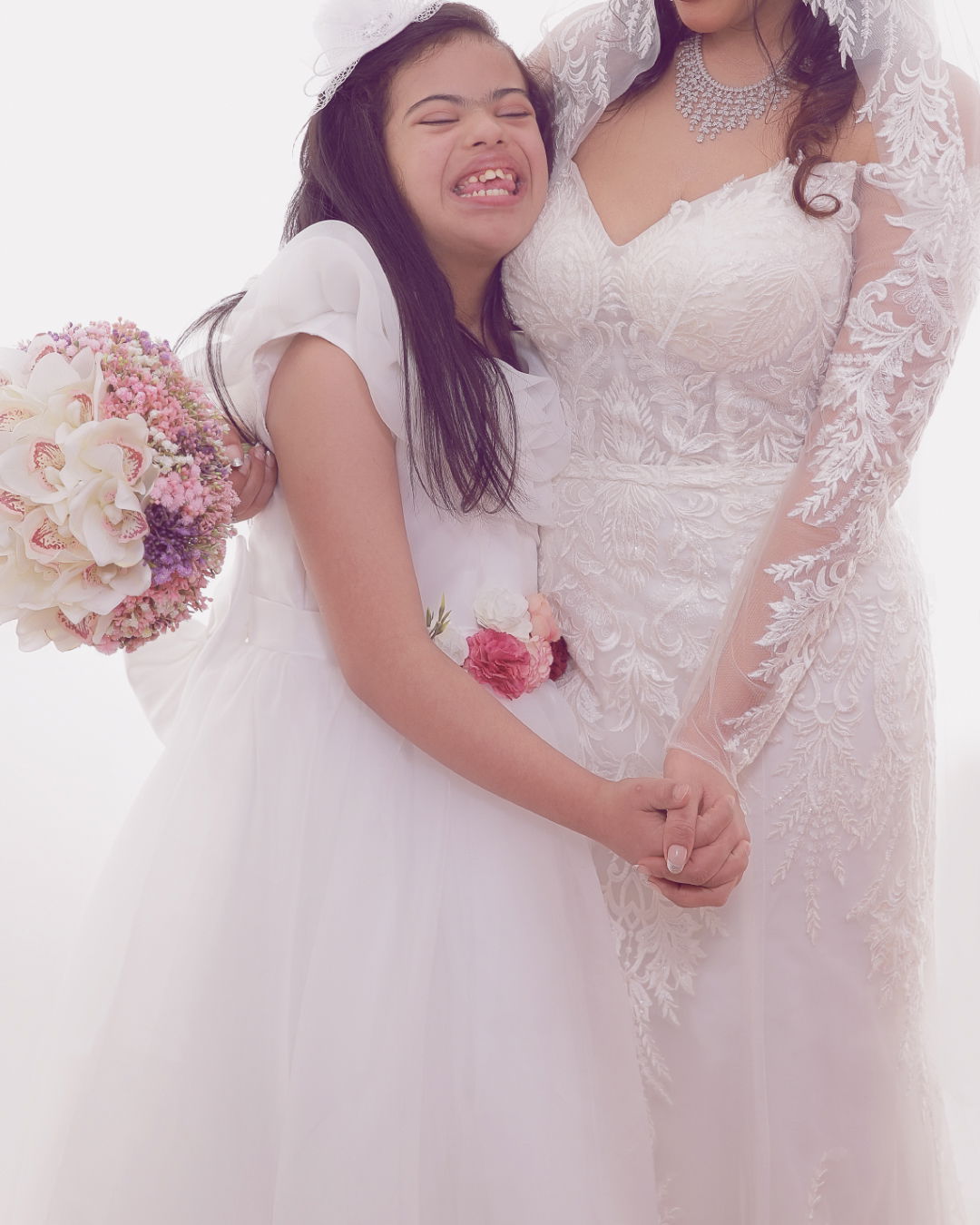 تصويرالآعراس